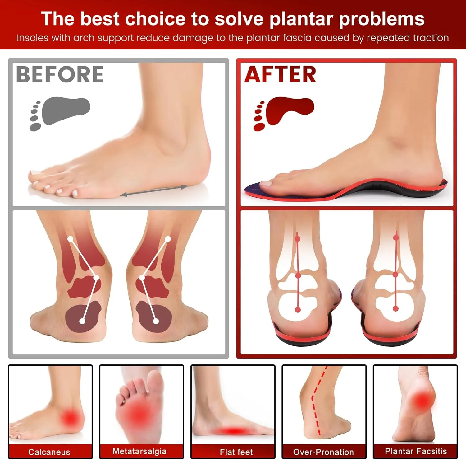 240 Ibs Plantar Fasciitis Insoles,FSA HSA Eligible,High Arch Support Inserts for Men Women,Heavy Duty Support for Orthotics Inserts,Flat Feet Insoles,Pain Relief,Work Boots & Sneakers (Red, L)