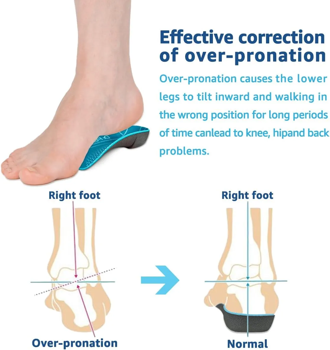 3/4 Orthotic Insoles, Shoe Inserts for Plantar Fasciitis Relief, High Arch Support Inserts for Flat Feet, Over-Pronation and Heel Pain (X-Large(Men's 11.5-14 / Women's 12.5-15))