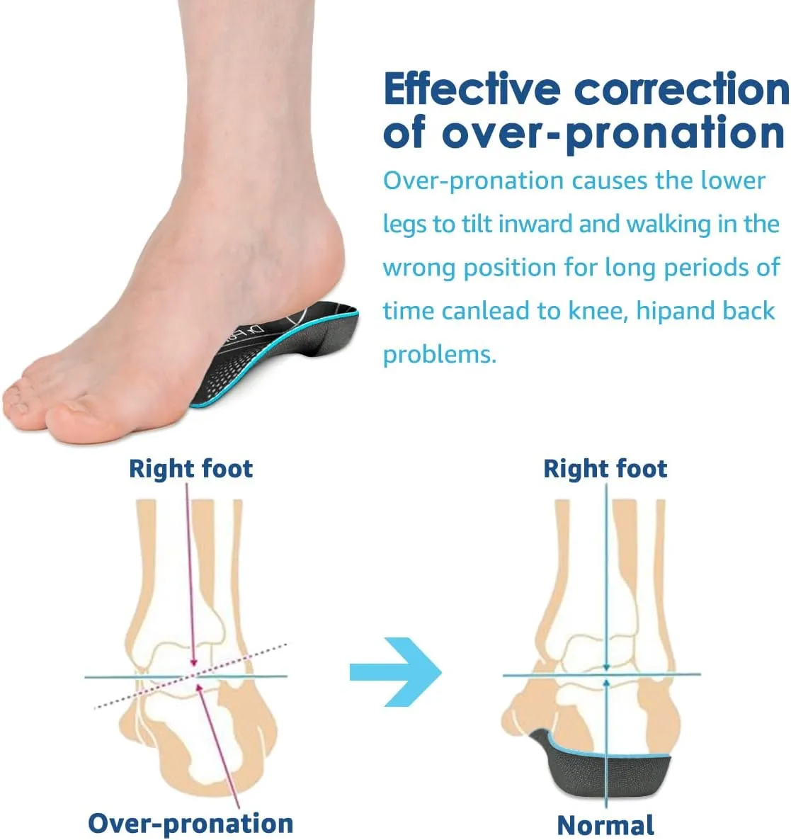 3/4 Plantar Fasciitis Insoles, High Arch Support Inserts for Flat Feet, Over-Pronation and Foot Pain, Metatarsal Support Insoles for Metatarsalgia (Large(Men's 9-11, Women's 10-12))