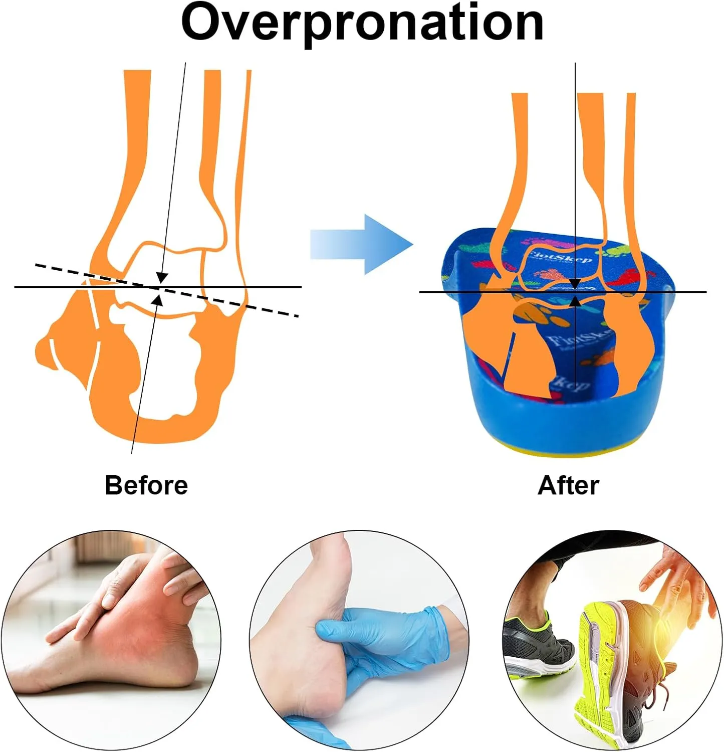 Kids Orthotics High Arch Support Insoles Over-Pronation Plantar Fasciitis Flat Feet PU Foam Inserts Relieve Children's Foot Pain, Gel Cushion for Heel Pain (7.5-10 M Toddler)