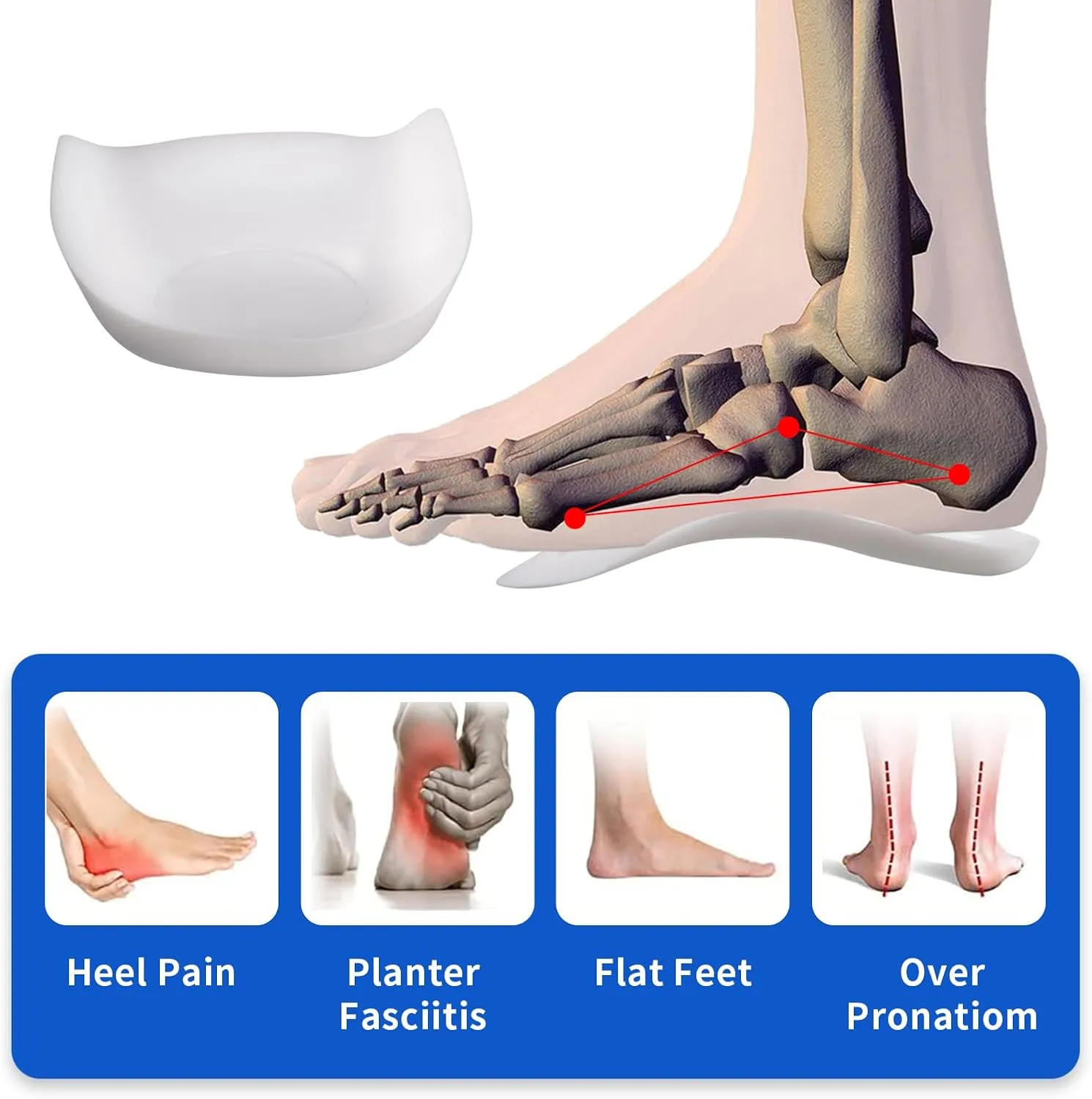 Original 3/4 Arch Support Metatarsal Support Orthotics Over-Pronation Insoles Relieve Plantar Fasciitis, Arch, Heel & Ankle Foot Pain (White, Men 9-12/Women 11-14)