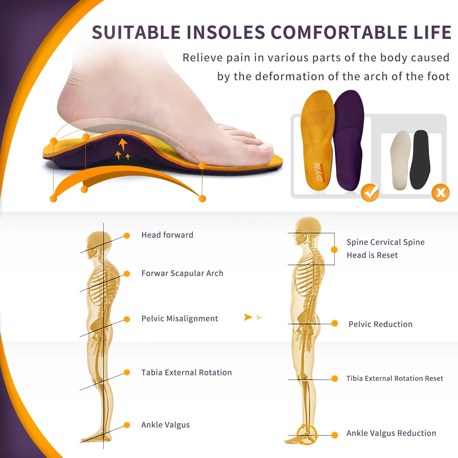 Plantar Fasciitis Relief Insoles,DynWalker Achilles Tendonitis Relief Orthopedic Insoles,Heel Spur,Flat Feet,overpronation,XS